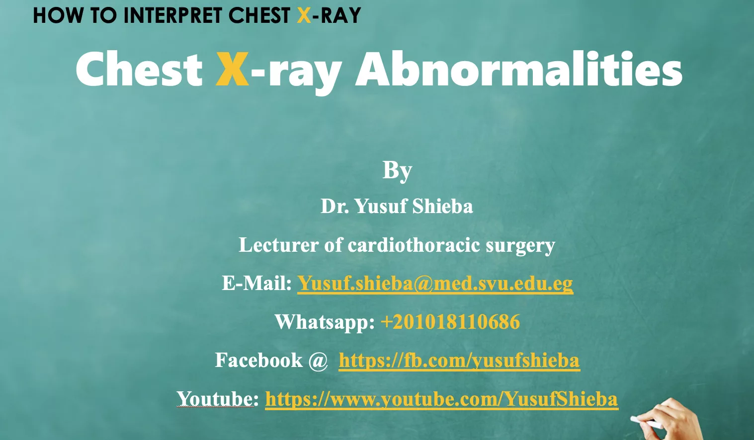 chest xray abnormalities